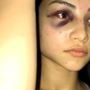 Woman seen beaten on viral video explains her actions