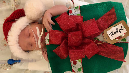 tiny baby christmas dress